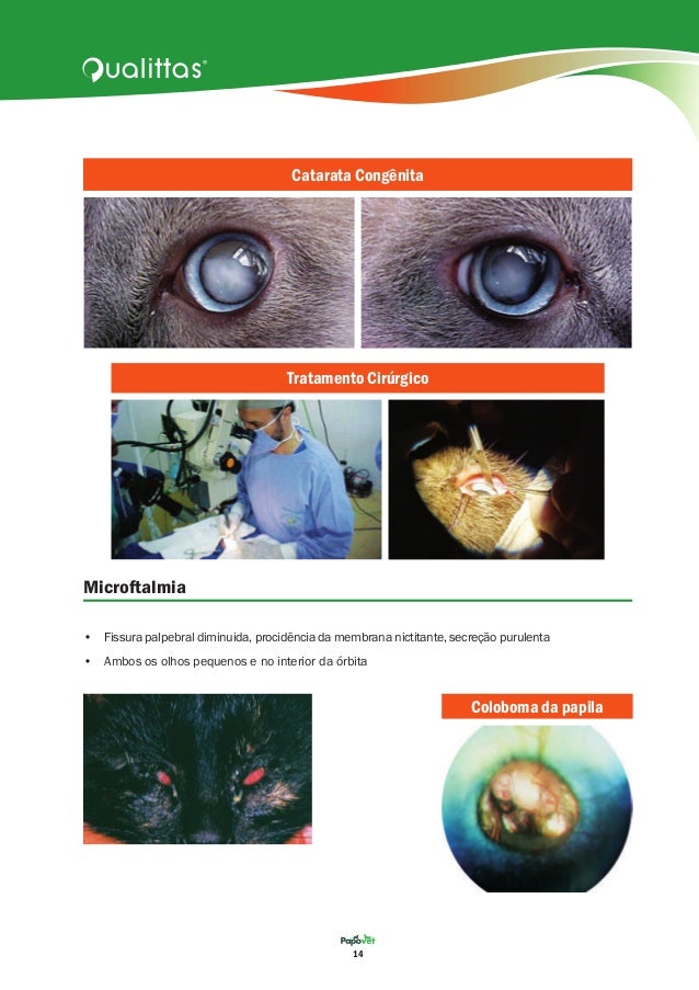 Catarata Congenita Ebook Download